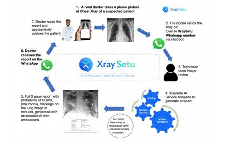 AI-driven ‘XraySetu’ to facilitate early COVID interventions