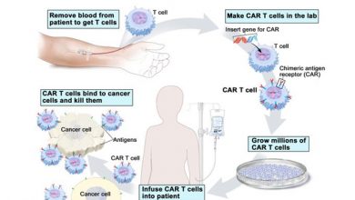 CAR-T cell technology gives hope for cancer treatment