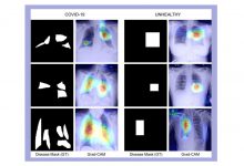 Researchers develop COVID-19 diagnosis technique using X-ray images