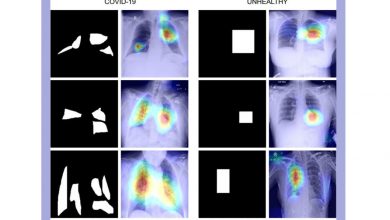 Researchers develop COVID-19 diagnosis technique using X-ray images