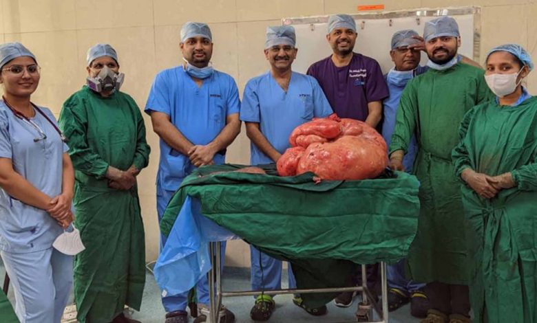 Doctors give new lease of life to woman by removing 47 kg tumour