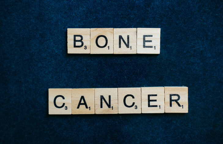 All About Bone Cancer: Risk Factors, Signs And Prevention